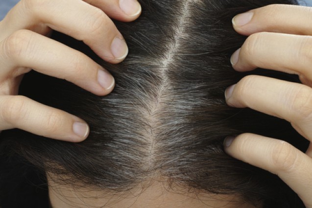 Rambut beruban