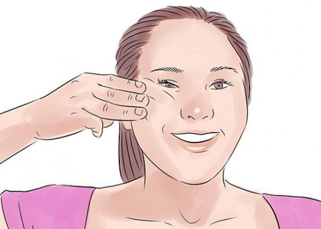Cheek lift